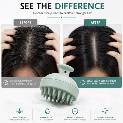 🔥 “Scalp Revive™ Brush – Instantly Removes Dandruff & Oil”